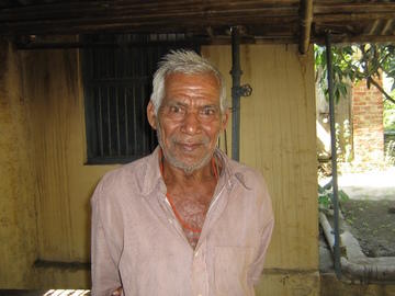 A leprosy victim